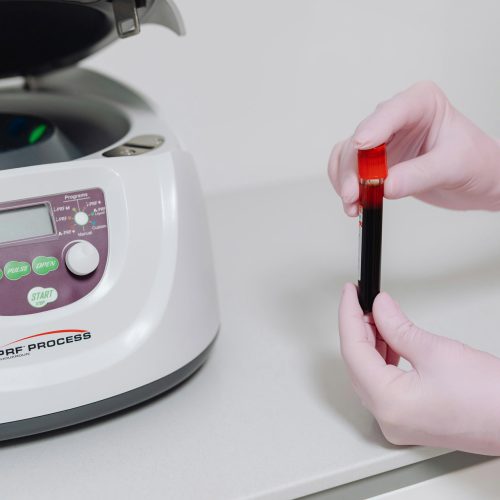 Hematologie